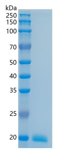 Active Recombinant Human Interleukin-28A (IL-28A / IFN-lambda 2) Protein