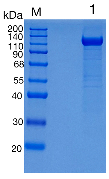 Active Recombinant Human Siglec-11 Protein
