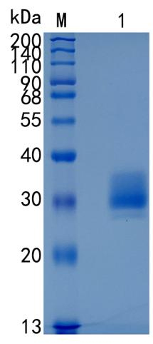 Active Recombinant Mouse IL-20 R beta / IL-20RB Protein