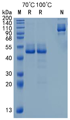 Active Recombinant Human TRAIL R1 / TNFRSF10A / CD261 Protein