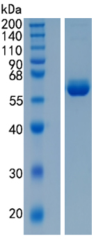 Active Recombinant Human BTN3A1 / CD277 Protein