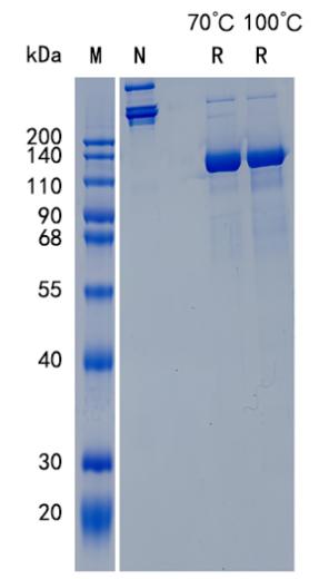 Active Recombinant Mouse Semaphorin 3A / SEMA3A Protein