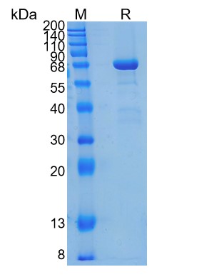 Active Recombinant Human EphB6 / Eph receptor B6 Protein