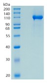 Active Recombinant Mouse Neuropilin-1 / NRP1 / CD304 Protein
