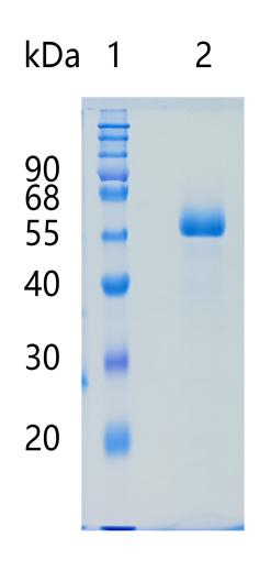 Active Recombinant Human HAI-1 / SPINT1 Protein