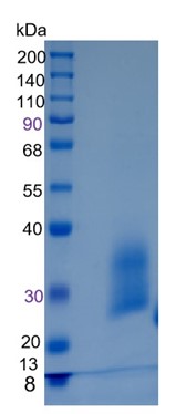 Active Recombinant Human HAI-2A / SPINT2 Protein