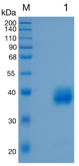 Active Recombinant Human Carbonic Anhydrase XII / CA12 Protein