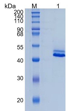 Active Recombinant Human CD5L / CT-2 / AIM Protein