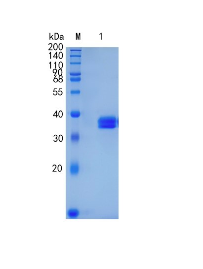 Active Recombinant Human Kallikrein 8 / KLK8 Protein