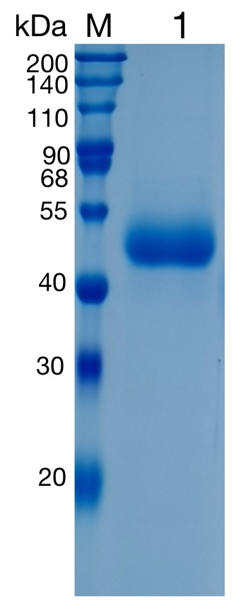 Active Recombinant Human TPST1 / Tyrosylprotein Sulfotransferase 1 Protein