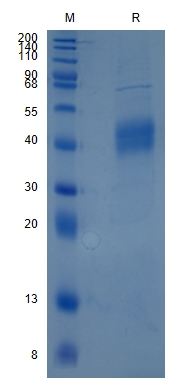 Active Recombinant Human Fc mu R / FAIM3 / TOSO Protein