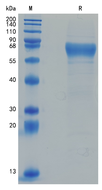 Active Recombinant Human ENTPD3 / CD39L3 Protein