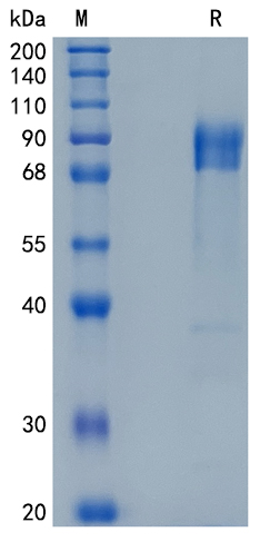 Active Recombinant Human DR6 / TNFRSF21 / CD358 Protein
