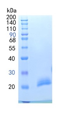 Active Recombinant Human PGRPS / PGLYRP1 Protein