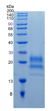 Active Recombinant Human Cystatin F / CST7 Protein