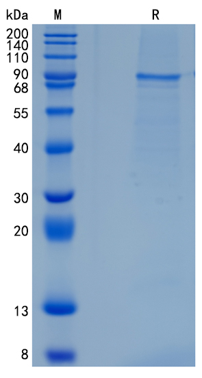 Active Recombinant Human Netrin-1 / NTN1 Protein