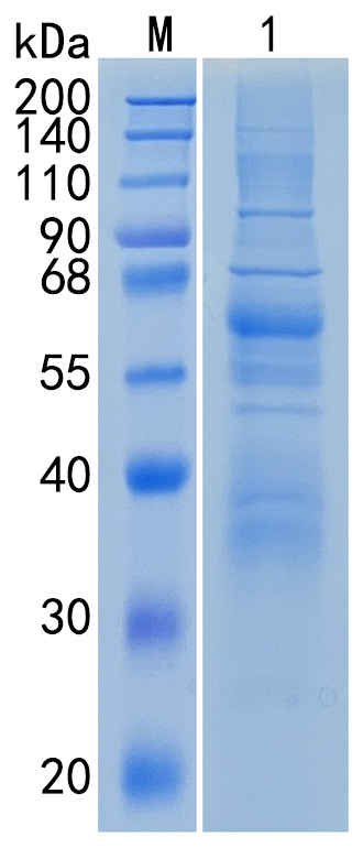 Active Recombinant Human Angiopoietin-like 1 / ANGPTL1 Protein