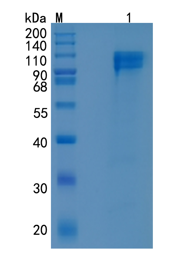 Active Recombinant Human Factor IX / PTC / Coagulation Factor IX Protein
