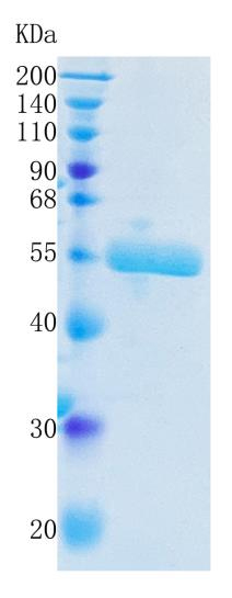 Active Recombinant Human Urokinase / PLAU Protein