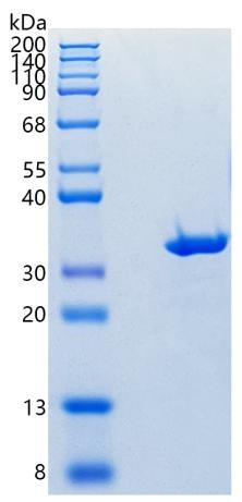 Active Recombinant Human Carbonic Anhydrase I / CA1 Protein