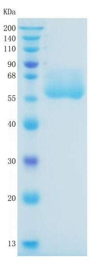 Active Recombinant Human AACT / Serpin A3 / Alpha-1-Antichymotrypsin Protein