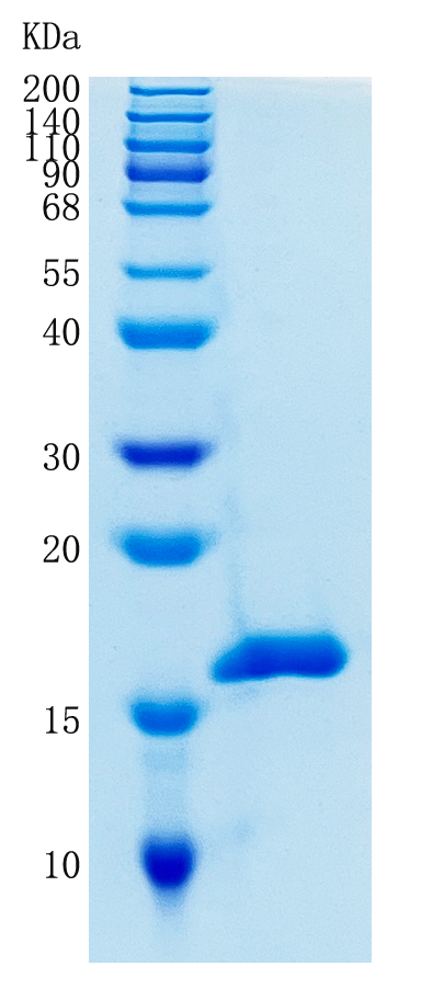 Active Recombinant Human Cystatin S / CST4 Protein