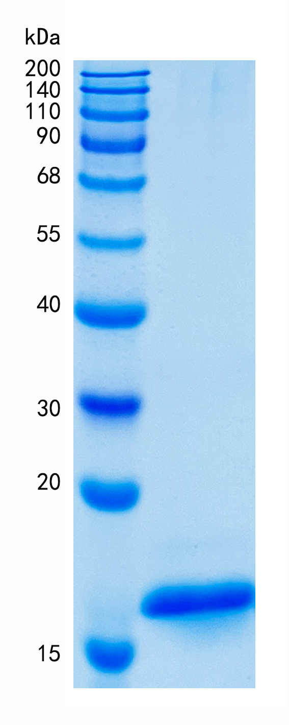 Active Recombinant Human Cystatin SN / CST1 Protein