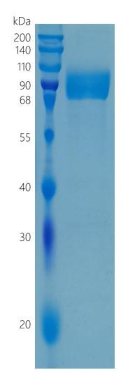 Active Recombinant Human IL-18 R alpha / IL-18R1 / CD218a Protein