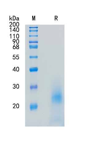 Active Recombinant Mouse Interleukin-3 / IL-3 Protein