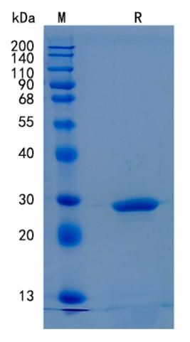 Active Recombinant Human Myoglobin / MB Protein