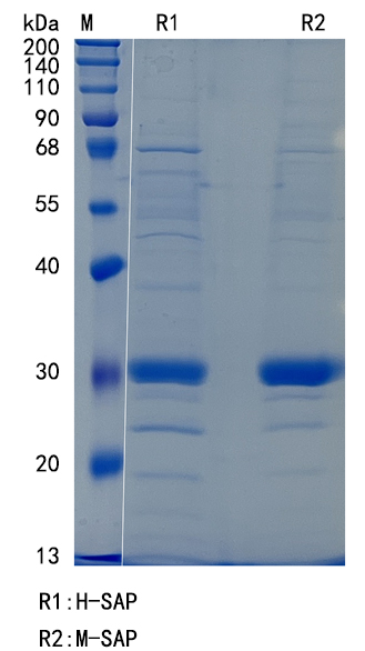 Active Recombinant Human Pentraxin 2 / SAP / Serum Amyloid P Component Protein