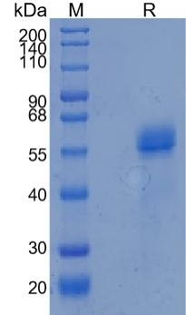 Active Recombinant Human Fetuin A / AHSG / Alpha-2-HS-Glycoprotein Protein