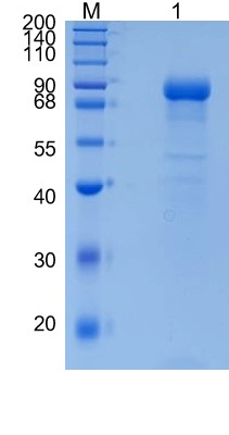 Active Recombinant Human Plasma Kallikrein / KLKB1 Protein
