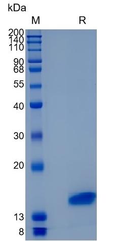 Active Recombinant Human TFF1 / pS2 / Estrogen-Inducible Protein Protein
