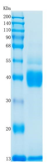 Active Recombinant Mouse TGF-beta 1 / Transforming Growth Factor-beta 1 Protein