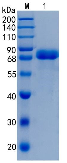 Active Recombinant Human A1BG / Alpha-1-B Glycoprotein Protein