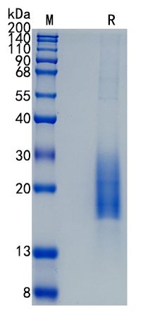 Active Recombinant Human CD3 delta / CD3D Protein
