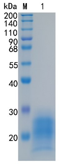 Active Recombinant Mouse Interleukin-5 / IL-5 Protein