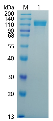 Active Recombinant Human Amyloid Precursor Protein / APP Protein