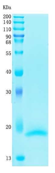 Active Recombinant Human Interleukin-4 / IL-4 Protein