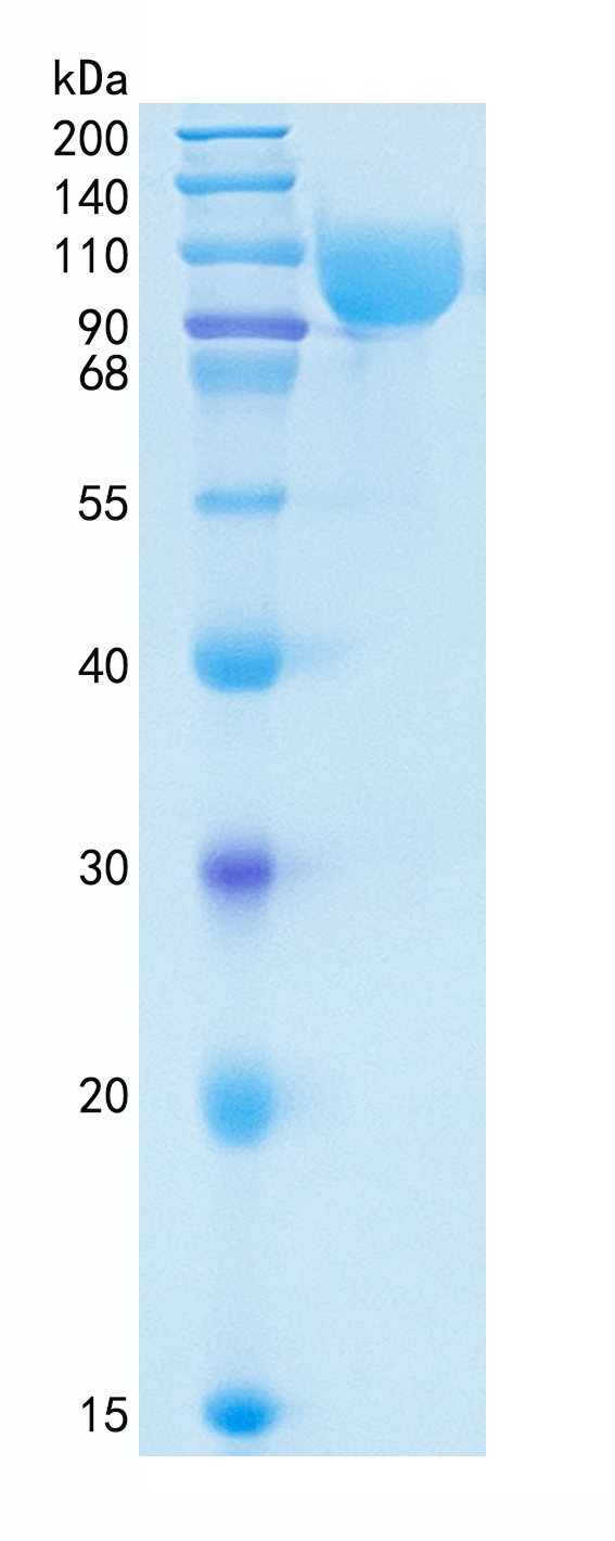 Active Recombinant Human Serpin G1 / C1 Inhibitor Protein