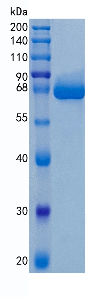 Active Recombinant Human Alkaline Phosphatase / ALPL / TNAP Protein