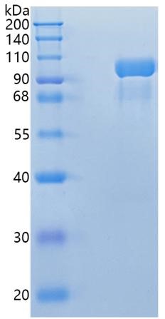 Active Recombinant Human Complement C2 / C2 Protein
