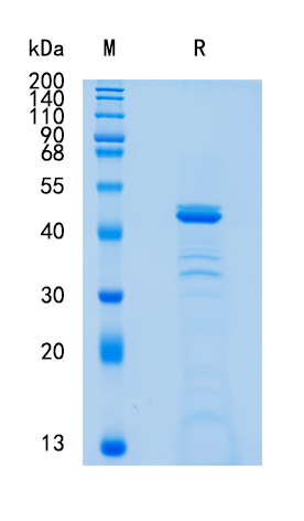 Active Recombinant Human Creatine Kinase MM / CKM Protein