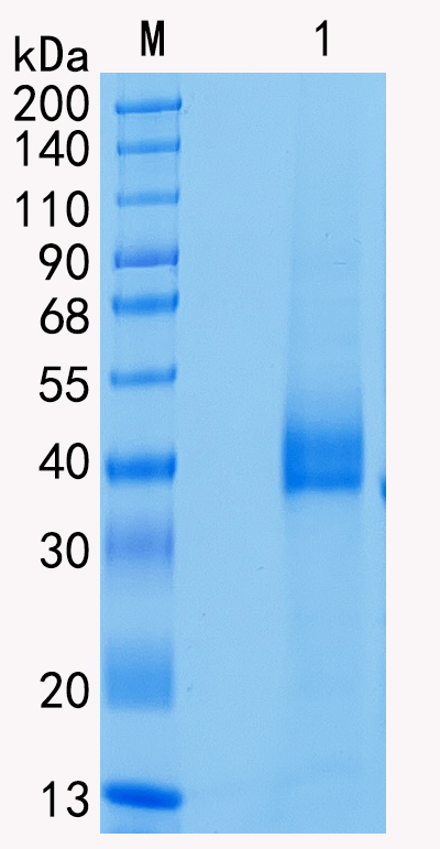 Active Recombinant Human Tissue Kallikrein / KLK1 Protein