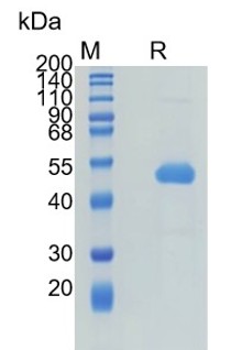 Active Recombinant Human SERPINE2 / PN-1 / Protease Nexin-1 Protein