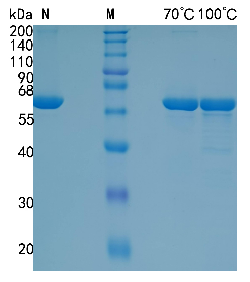 Active Recombinant Human P4HB / PDI / Prolyl 4-Hydroxylase beta Protein