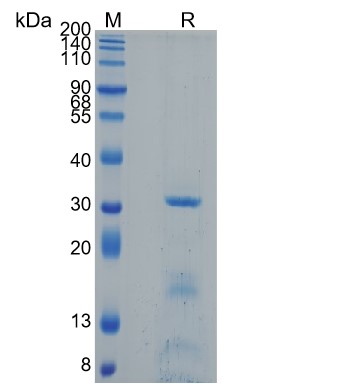 Active Recombinant Human Trypsin-2 / PRSS2 Protein