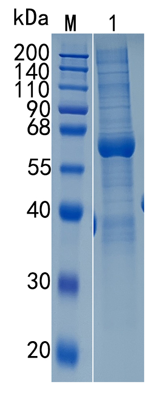 Active Recombinant Human HEXB / Beta-hexosaminidase beta chain Protein
