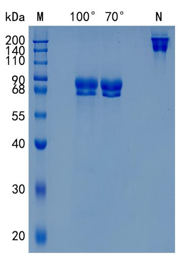 Active Recombinant Human p75 NGF Receptor / TNFRSF16 / CD271 Protein